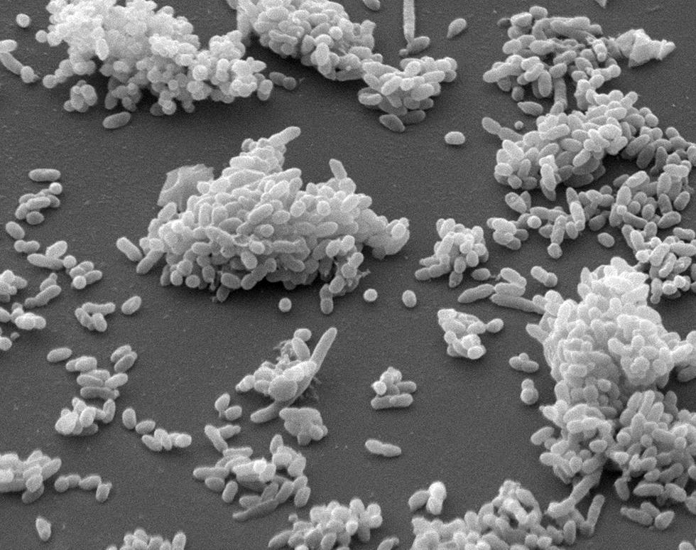 Haemophilus influenzae colony